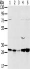 TPD52 Like 2 antibody, TA351839, Origene, Western Blot image 