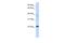 Chromosome 11 Open Reading Frame 74 antibody, A18219, Boster Biological Technology, Western Blot image 