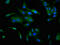 Cholecystokinin receptor type A antibody, CSB-PA004772LA01HU, Cusabio, Immunofluorescence image 