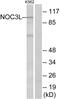 NOC3 Like DNA Replication Regulator antibody, PA5-39314, Invitrogen Antibodies, Western Blot image 