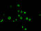 Histone Cluster 1 H1 Family Member E antibody, LS-C670375, Lifespan Biosciences, Immunofluorescence image 