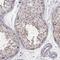Kidney Associated Antigen 1 antibody, HPA036021, Atlas Antibodies, Immunohistochemistry paraffin image 
