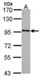 MLLT10 Histone Lysine Methyltransferase DOT1L Cofactor antibody, PA5-28399, Invitrogen Antibodies, Western Blot image 