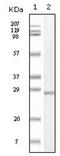 S100 Calcium Binding Protein A1 antibody, AM06160SU-N, Origene, Western Blot image 