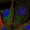 Diacylglycerol Kinase Delta antibody, NBP2-58630, Novus Biologicals, Immunofluorescence image 