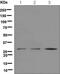 Steroid 5 Alpha-Reductase 2 antibody, ab124877, Abcam, Western Blot image 