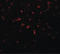 Arginine And Serine Rich Coiled-Coil 1 antibody, LS-C108662, Lifespan Biosciences, Immunofluorescence image 