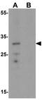 CCAAT Enhancer Binding Protein Delta antibody, GTX17179, GeneTex, Western Blot image 