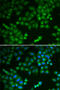 Ribosomal Protein L5 antibody, 18-425, ProSci, Immunofluorescence image 