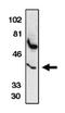 Fli-1 Proto-Oncogene, ETS Transcription Factor antibody, orb108730, Biorbyt, Western Blot image 