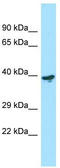 LYPD3 antibody, TA338090, Origene, Western Blot image 