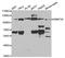 DNA Methyltransferase 3 Alpha antibody, A2065, ABclonal Technology, Western Blot image 