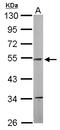 NADH:Ubiquinone Oxidoreductase Core Subunit V1 antibody, LS-B10759, Lifespan Biosciences, Western Blot image 