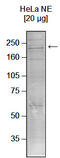 Chromodomain Helicase DNA Binding Protein 1 antibody, TA347100, Origene, Western Blot image 