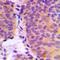 Chondroitin Sulfate Synthase 3 antibody, orb224121, Biorbyt, Immunohistochemistry paraffin image 