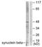 Synuclein Beta antibody, TA312076, Origene, Western Blot image 