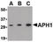Aph-1 Homolog A, Gamma-Secretase Subunit antibody, LS-B443, Lifespan Biosciences, Western Blot image 