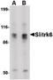 SLIT And NTRK Like Family Member 6 antibody, PA5-20479, Invitrogen Antibodies, Western Blot image 