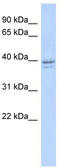 Ribonucleotide Reductase Regulatory Subunit M2 antibody, TA338976, Origene, Western Blot image 