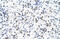 Ferrochelatase, mitochondrial antibody, ARP41865_P050, Aviva Systems Biology, Immunohistochemistry paraffin image 