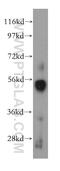 Prolyl 3-Hydroxylase Family Member 4 (Non-Enzymatic) antibody, 15288-1-AP, Proteintech Group, Western Blot image 