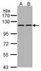 Glutamyl Aminopeptidase antibody, LS-B4216, Lifespan Biosciences, Western Blot image 