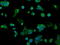 Alcohol dehydrogenase [NADP+] antibody, GTX84913, GeneTex, Immunofluorescence image 