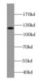Catenin Delta 1 antibody, FNab06060, FineTest, Western Blot image 