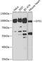 Glycogen Synthase 1 antibody, 18-683, ProSci, Western Blot image 