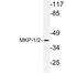 Dual specificity protein phosphatase 1 antibody, LS-C177799, Lifespan Biosciences, Western Blot image 