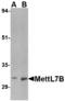 Methyltransferase-like protein 7B antibody, A17310, Boster Biological Technology, Western Blot image 