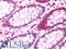 Forkhead Box P1 antibody, LS-B10721, Lifespan Biosciences, Immunohistochemistry paraffin image 