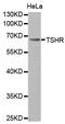 Thyroid Stimulating Hormone Receptor antibody, MBS125170, MyBioSource, Western Blot image 