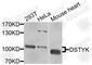 Dual serine/threonine and tyrosine protein kinase antibody, A9870, ABclonal Technology, Western Blot image 