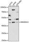 MAGE Family Member A11 antibody, LS-C750258, Lifespan Biosciences, Western Blot image 