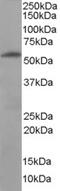 Formimidoyltransferase-cyclodeaminase antibody, TA302954, Origene, Western Blot image 