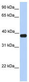 Ankyrin Repeat And SOCS Box Containing 5 antibody, TA342096, Origene, Western Blot image 