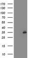 Sirtuin 5 antibody, TA503280, Origene, Western Blot image 
