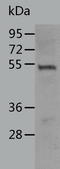 RUNX Family Transcription Factor 3 antibody, TA322762, Origene, Western Blot image 