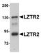 Protein transport protein Sec16B antibody, A06452, Boster Biological Technology, Western Blot image 