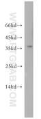 Alcohol Dehydrogenase 1C (Class I), Gamma Polypeptide antibody, 18897-1-AP, Proteintech Group, Western Blot image 