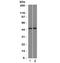 Friend leukemia integration 1 transcription factor antibody, V7218-100UG, NSJ Bioreagents, Western Blot image 