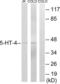 5-Hydroxytryptamine Receptor 4 antibody, LS-C119371, Lifespan Biosciences, Western Blot image 