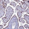 Protein FAM3C antibody, HPA043376, Atlas Antibodies, Immunohistochemistry paraffin image 