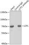 Lymphocyte Cytosolic Protein 1 antibody, GTX33300, GeneTex, Immunoprecipitation image 