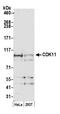 Cyclin-dependent kinase 11 antibody, A300-311A, Bethyl Labs, Western Blot image 