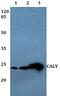 Calcyon Neuron Specific Vesicular Protein antibody, PA5-37112, Invitrogen Antibodies, Western Blot image 