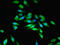 Serine/Threonine Kinase 33 antibody, orb356987, Biorbyt, Immunofluorescence image 