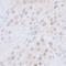 CTR9 Homolog, Paf1/RNA Polymerase II Complex Component antibody, A301-395A, Bethyl Labs, Immunohistochemistry paraffin image 