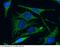 Complement C1q Binding Protein antibody, 11874-MM04, Sino Biological, Immunohistochemistry frozen image 